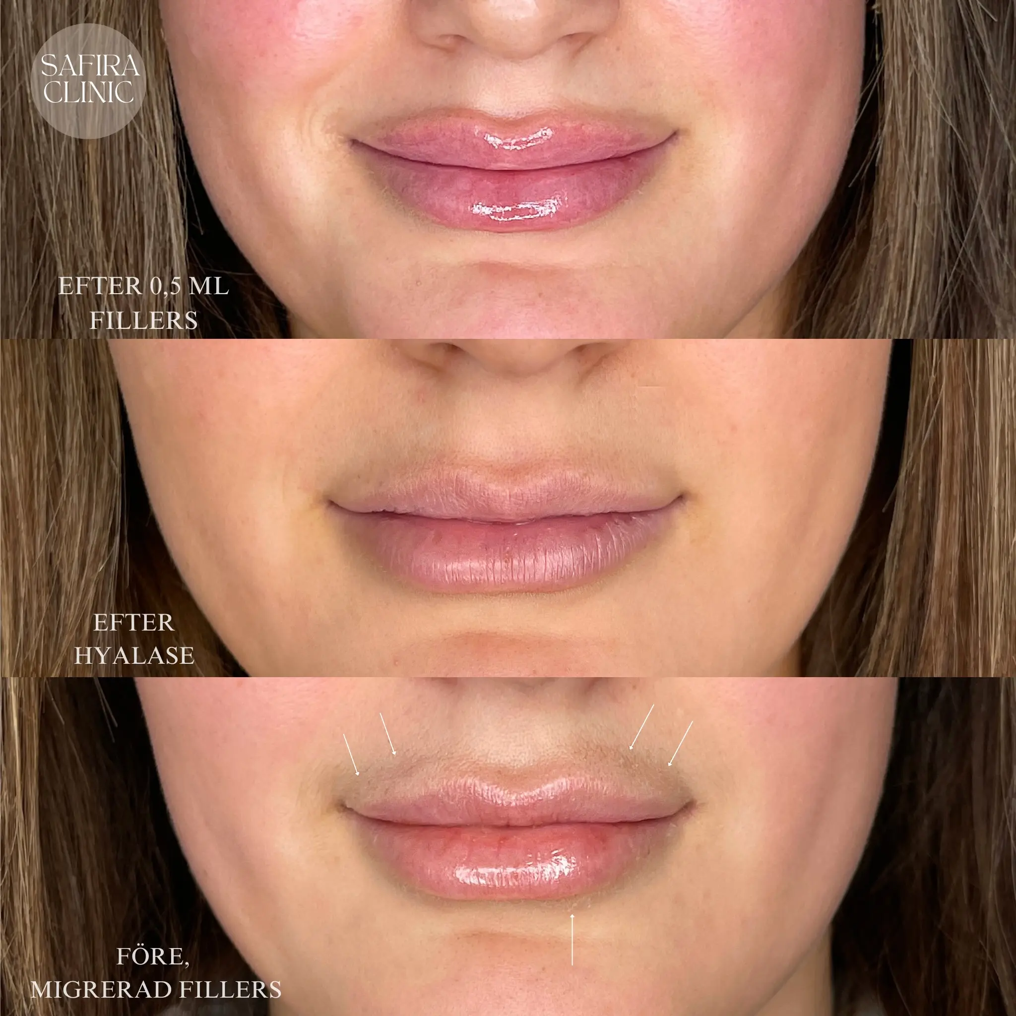 Facetune_09-03-2025-11-01-52