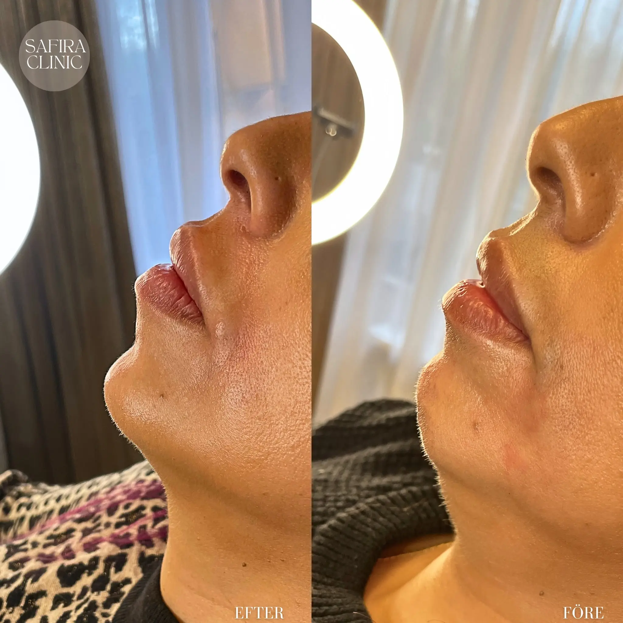 Facetune_09-11-2024-20-27-23