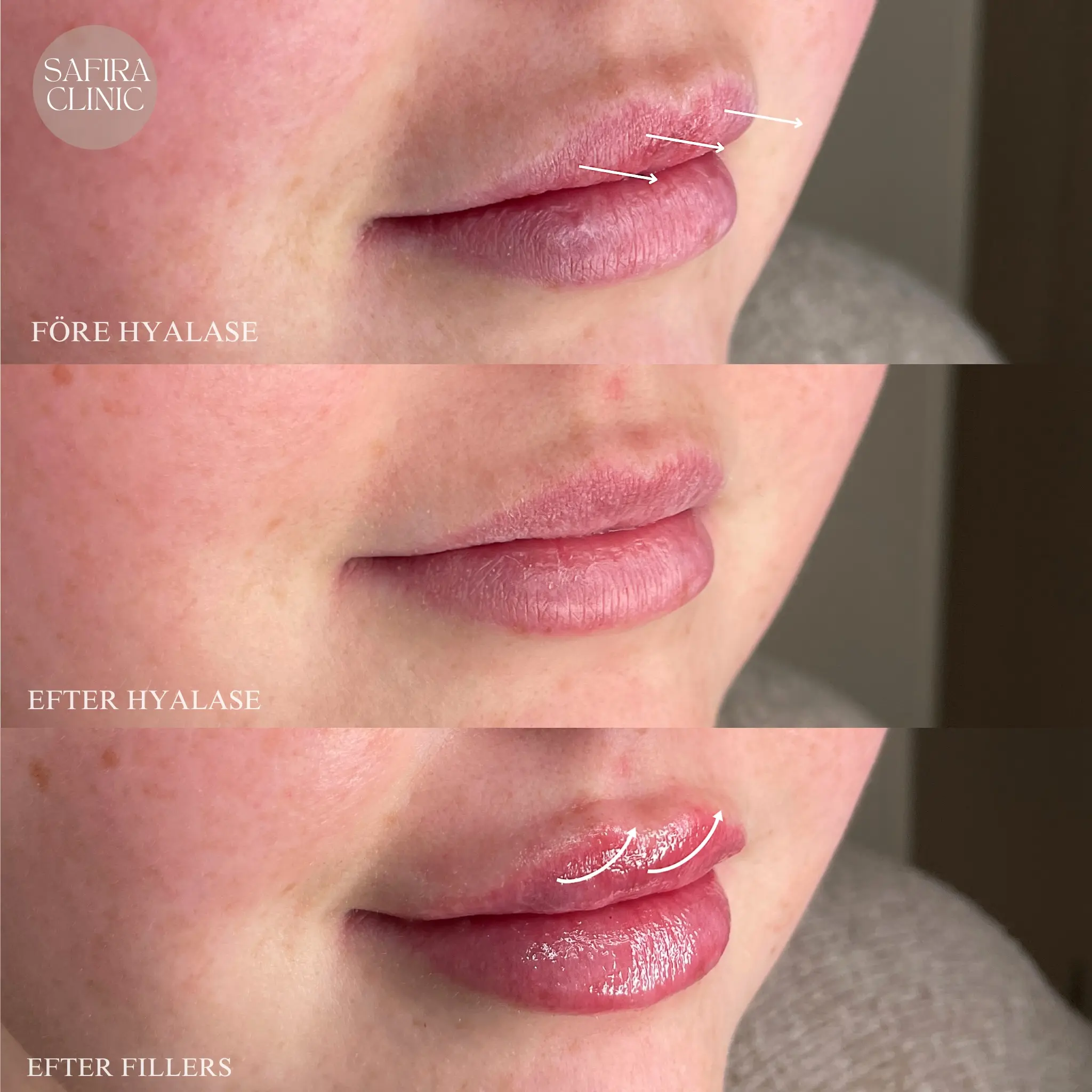 Facetune_11-03-2025-19-19-32 (1)