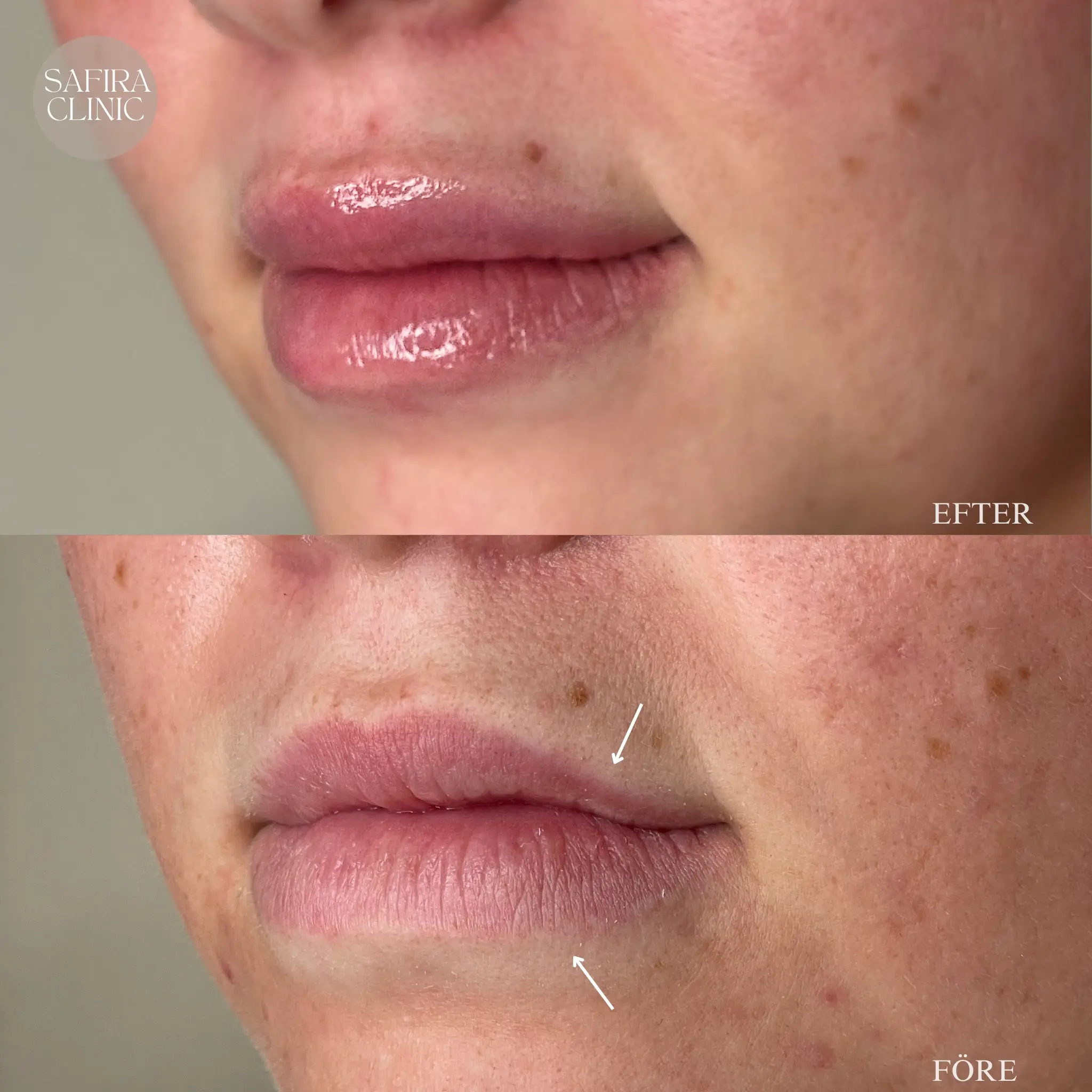 Facetune_16-01-2025-17-48-54