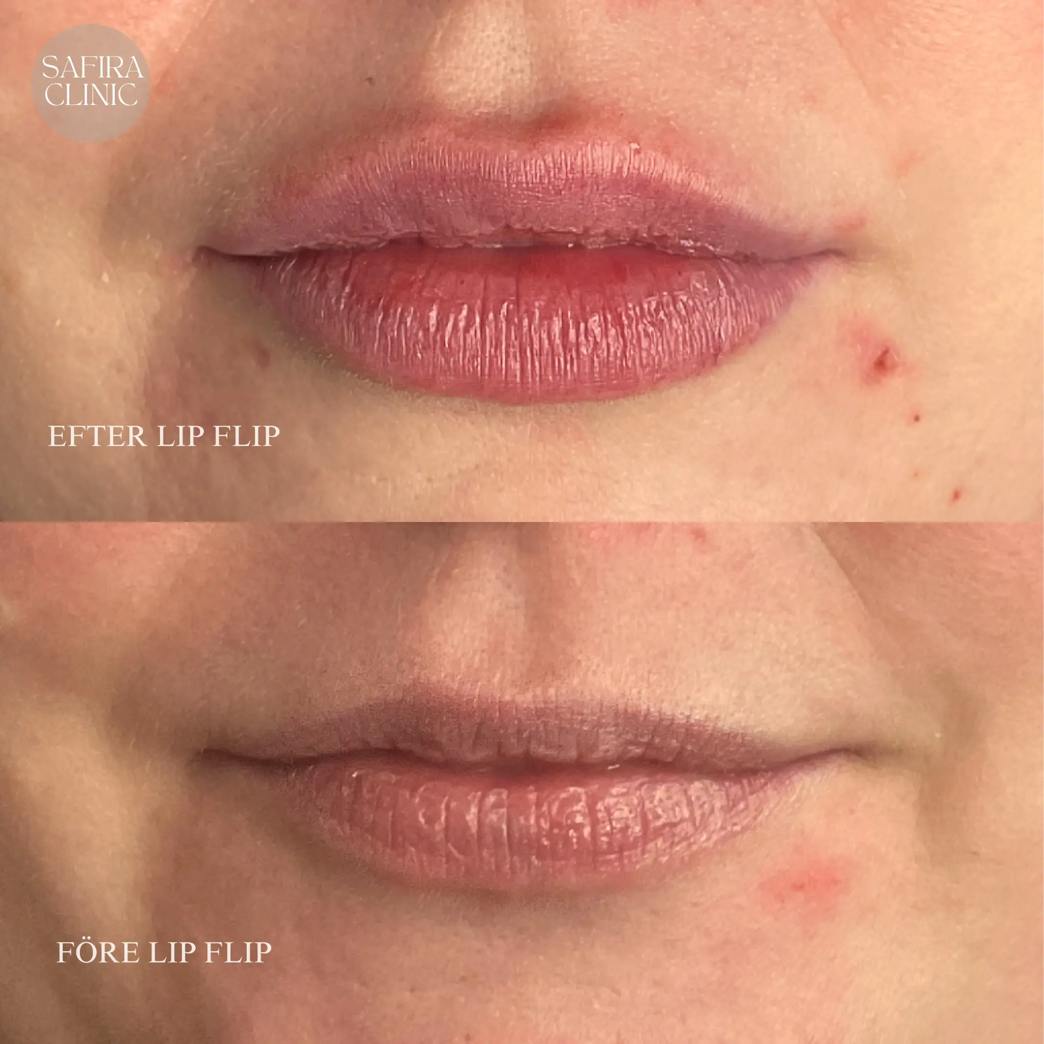 Facetune_19-08-2024-08-17-34