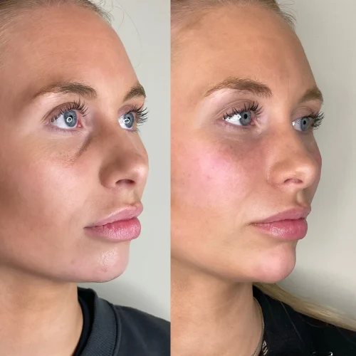 B6B44C2D-0533-42E8-A303-DDF1AFF090E6