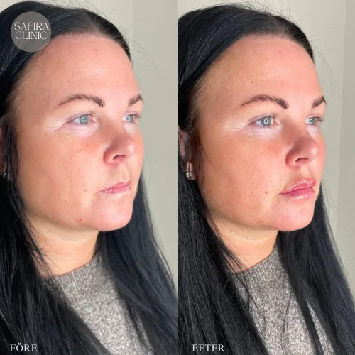 Facetune_01-03-2025-13-34-40