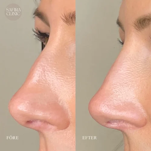 Facetune_06-04-2024-11-18-44