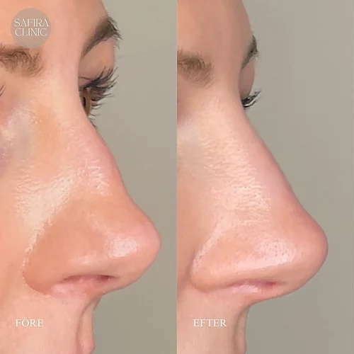 Facetune_06-04-2024-11-20-04