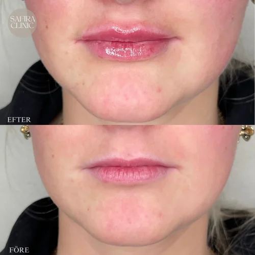 Facetune_09-11-2024-21-18-13