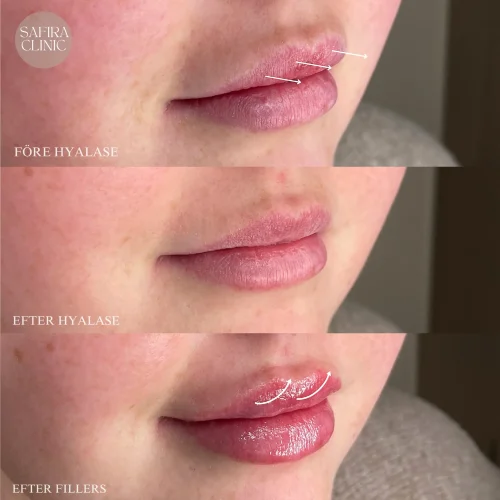 Facetune_11-03-2025-19-19-32