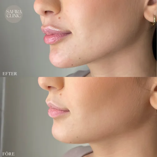 Facetune_20-11-2024-19-53-20